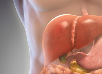 Diet Hepatitis, Solusi Diet untuk Cegah dan Pulihkan Hepatitis