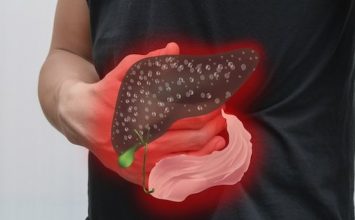 4 Bahaya Hepatitis, Penyakit Pencuri Hati