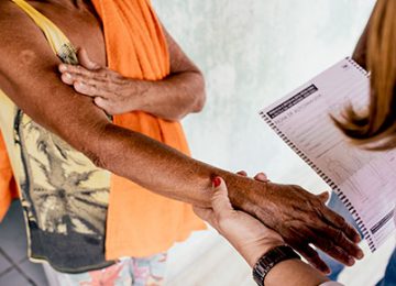 Yuk Pahami, Lawan, Cegah Penyakit Kusta!