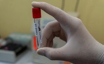Benarkah Jenis Golongan Darah Memengaruhi Infeksi Covid-19?