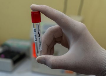 Benarkah Jenis Golongan Darah Memengaruhi Infeksi Covid-19?