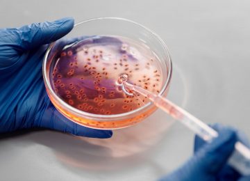 SEA Probiotics SREN, Perkembangan Probiotik di Masa Kini