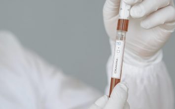 Anemia Memperparah Covid-19