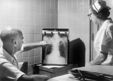 Kaitan Pencahayaan dan Ventilasi dengan Tuberkulosis Paru