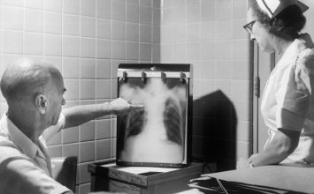 Waspadai Risiko Tinggi Tuberculosis pada Penderita Diabetes Mellitus